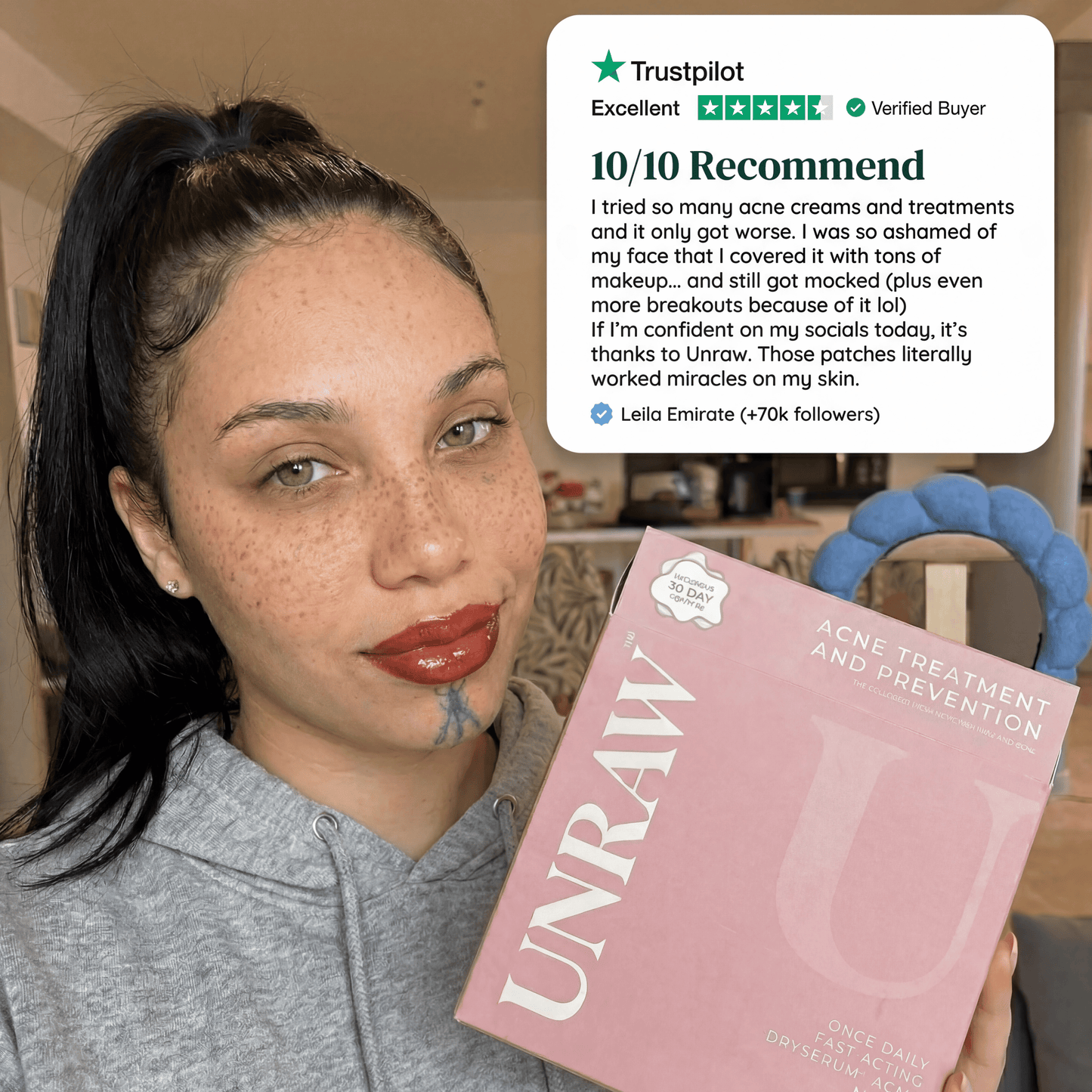 Acne Clearing & Skin Healing Regimen